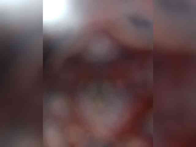 Annanas webcam
