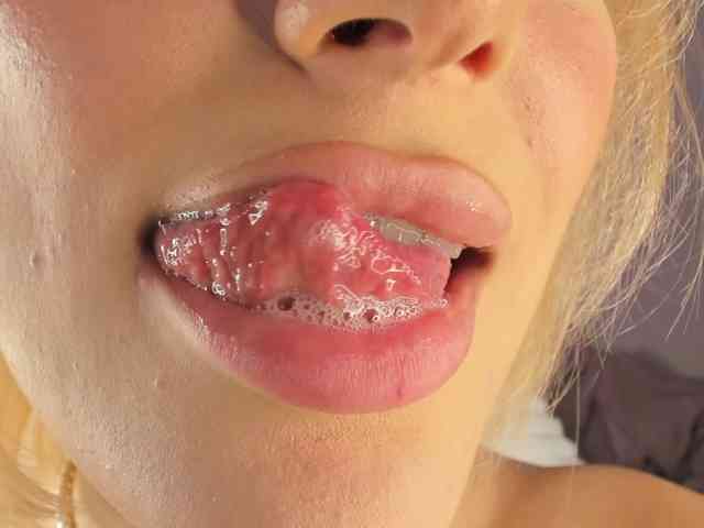 IceStrawberry IceStrawberry