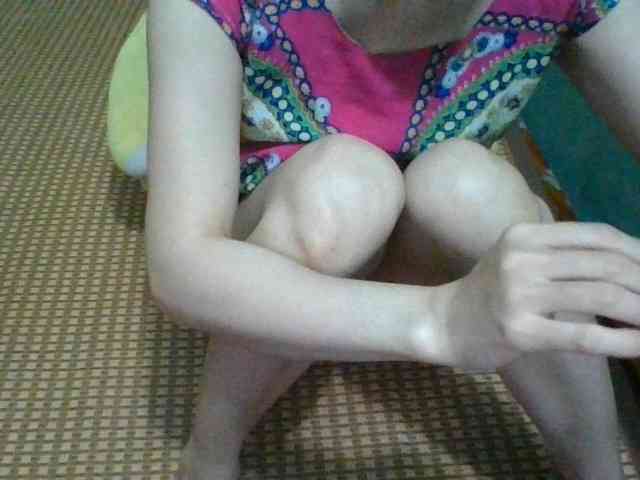 Anamis