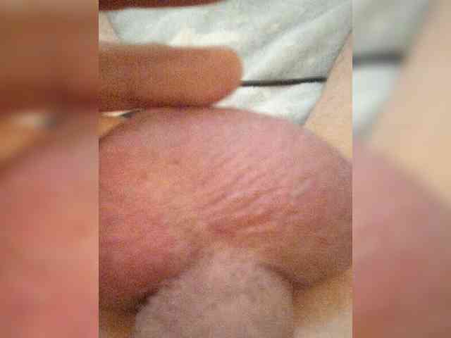 MrHot95
