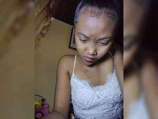 Stella11 webcam