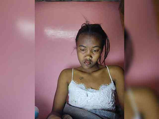 Stella11 webcam