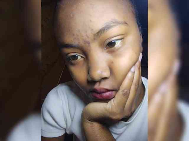 Stella11 webcam