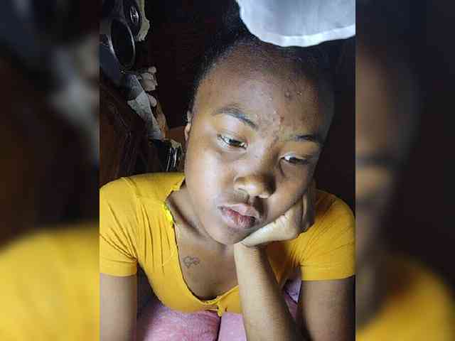 Stella11 webcam
