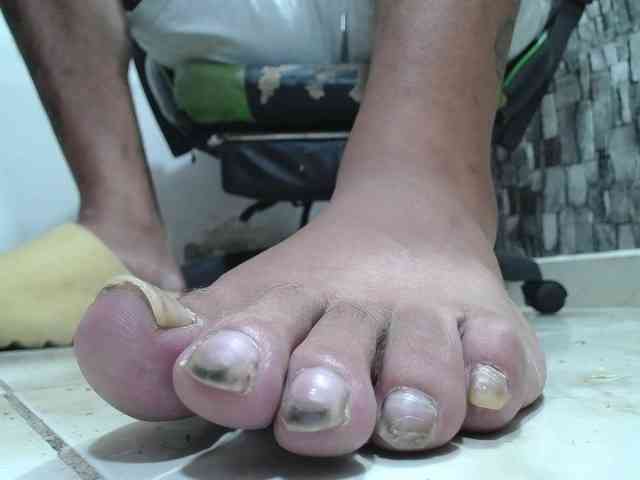 srfindomfeetdraining
