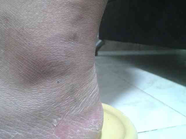 srfindomfeetdraining