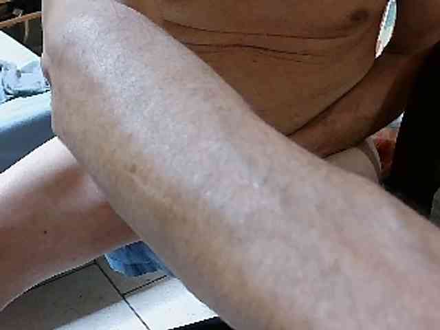 absab