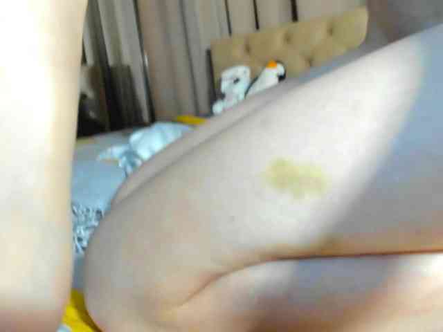 lesyalis