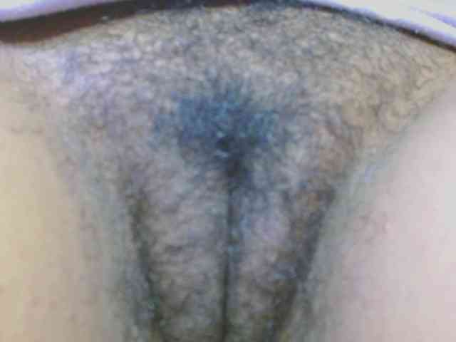 hairygirl83