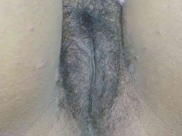 hairygirl83