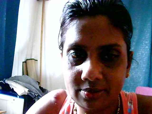 Model: Anshia