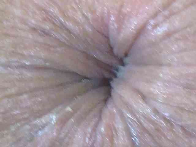 Anasquirt69