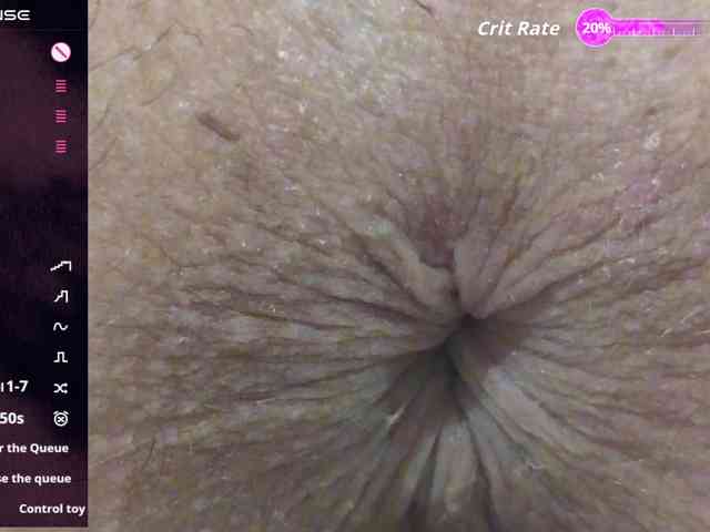 Anasquirt69