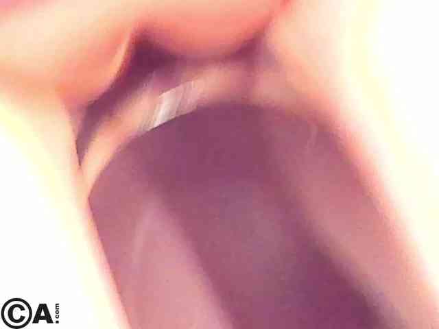 MiaFerd webcam