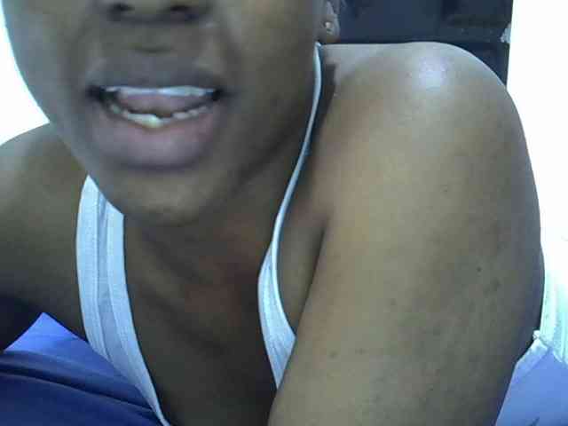 Bernice2