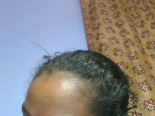 rosah1a