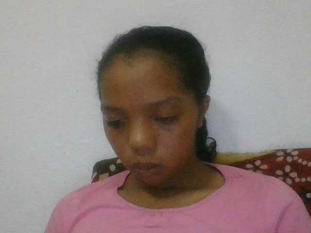 rosah1a