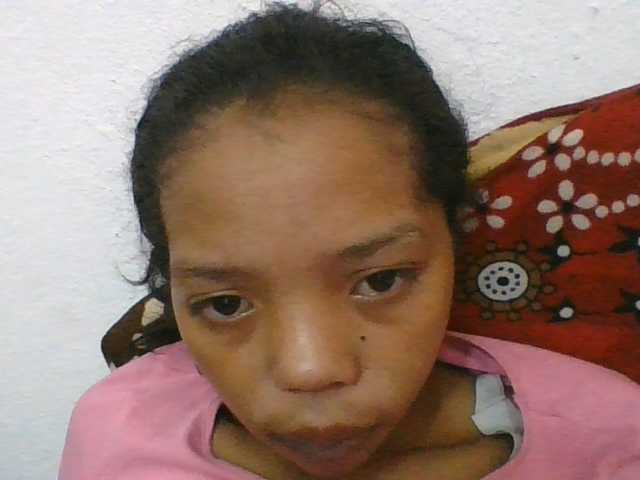 rosah1a