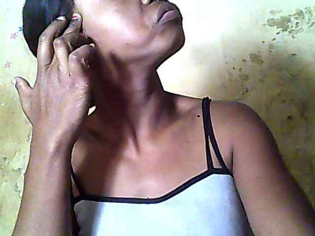 Roxane-1