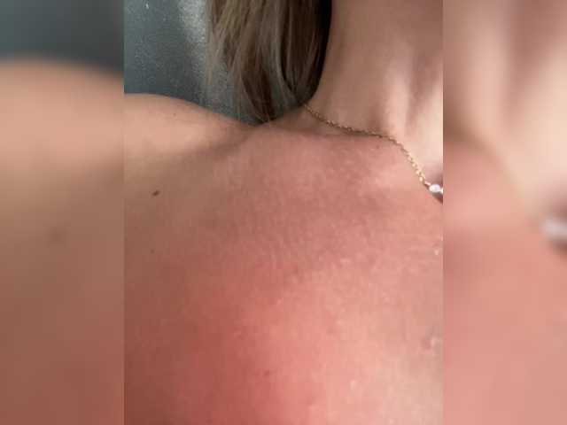 Sex-mia
