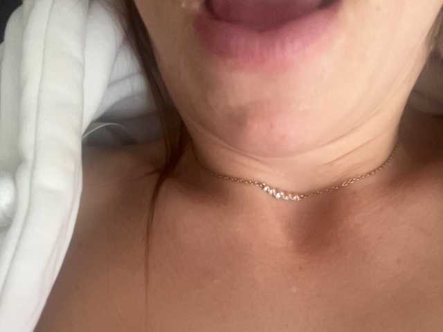 Sex-mia