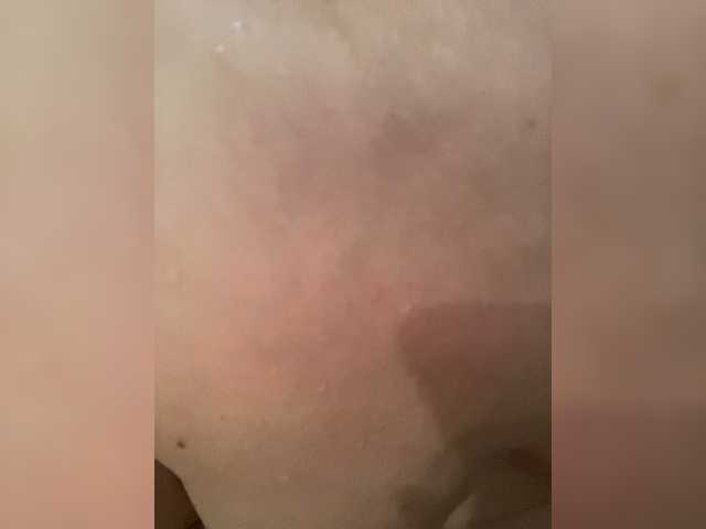 Sex-mia
