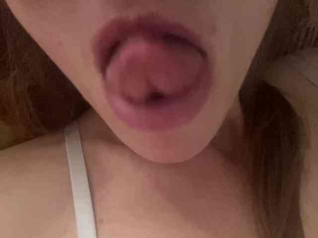 Sex-mia