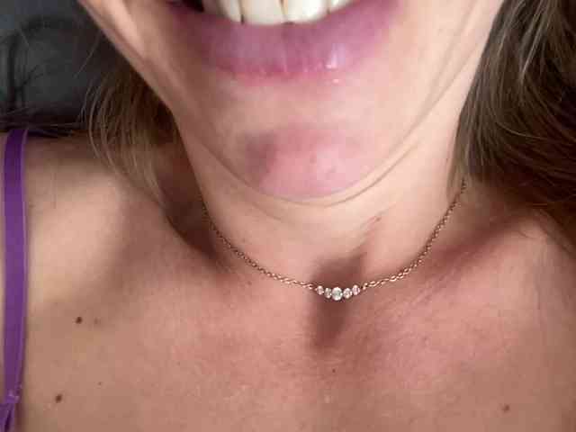 Sex-mia