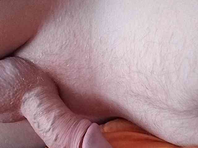 Max35b