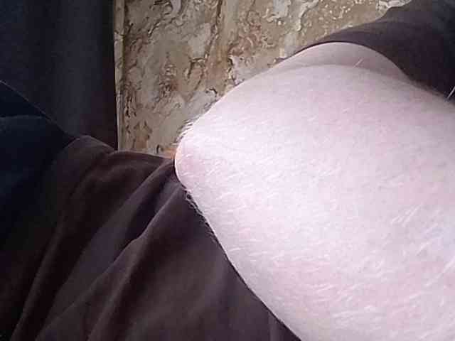 Max35b