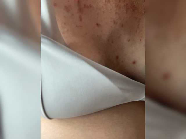 Kisa77771a