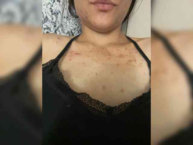 Kisa77771a webcam