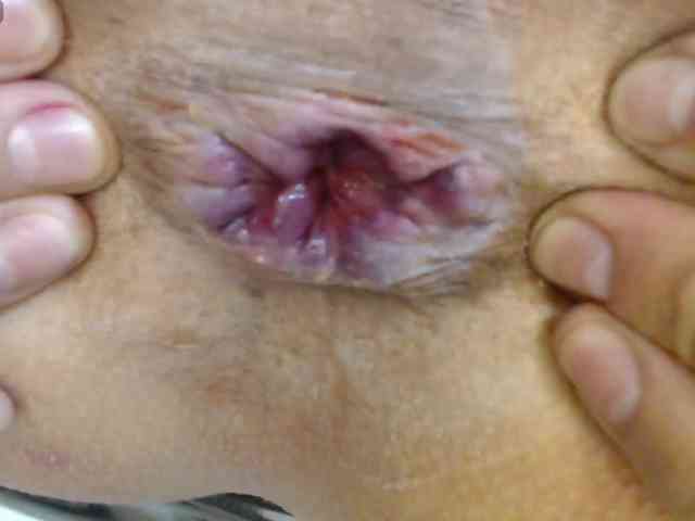 alonddra-tay webcam