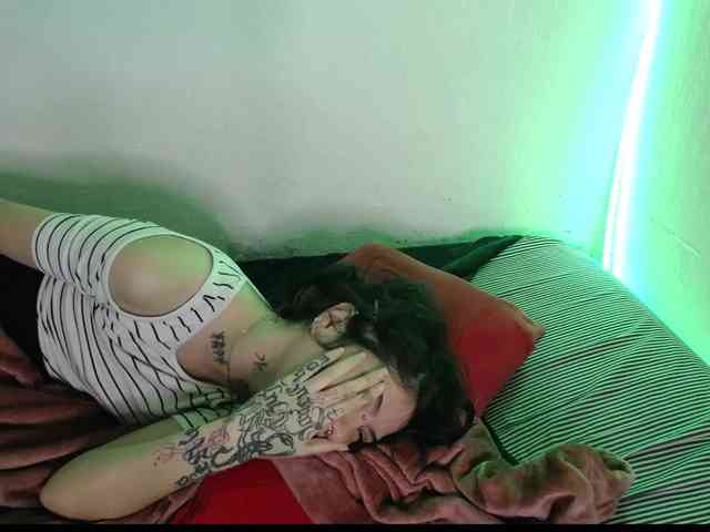 IviCure webcam