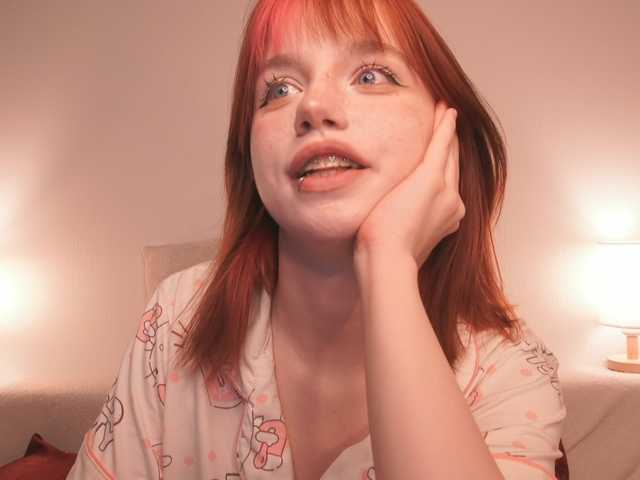 rubydalloss