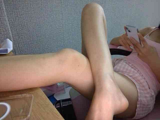 Lynny-1 webcam