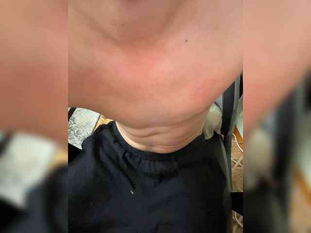 Boyskaus