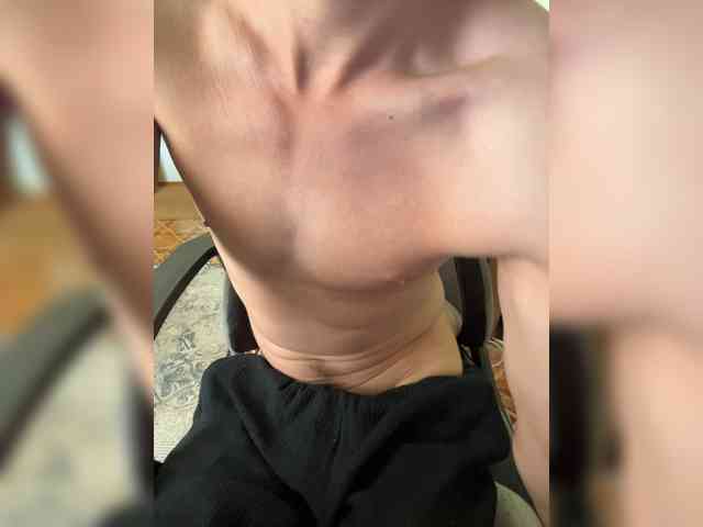 Boyskaus