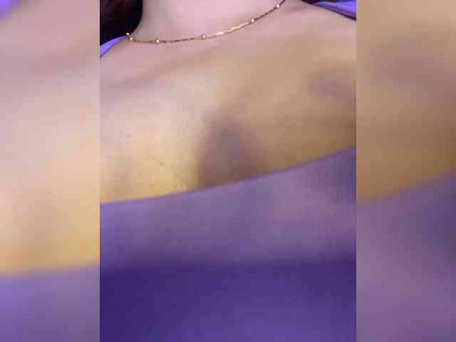 Allie-Rosse Allie-Rosse