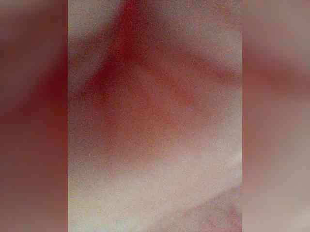 -COVID-19- webcam