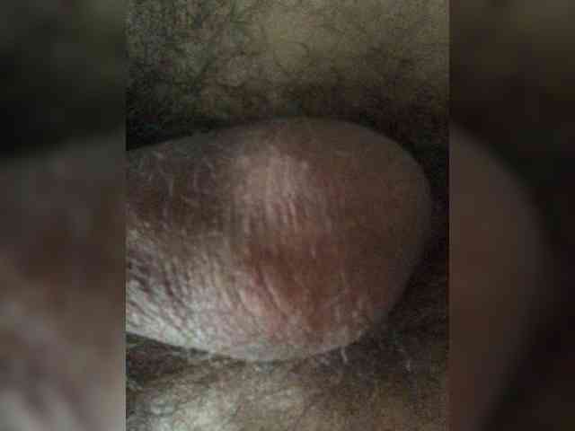 Antinb