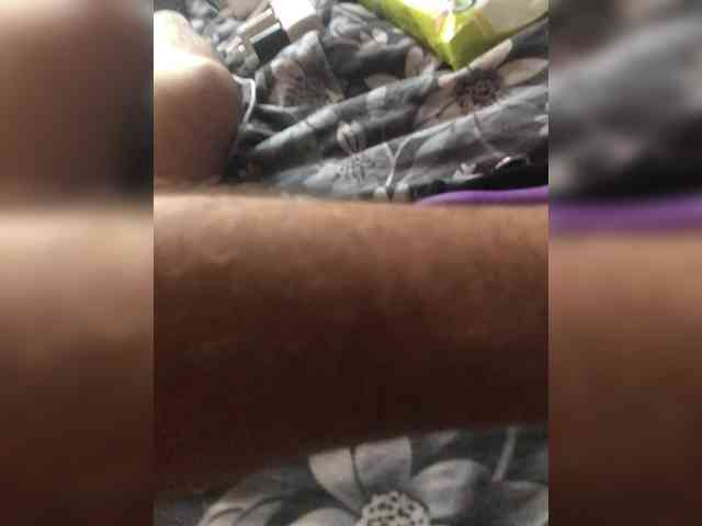 Antinb