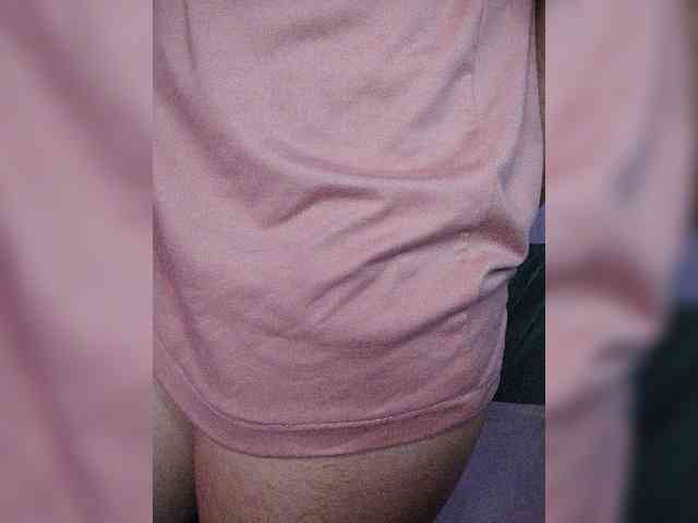 skinny333