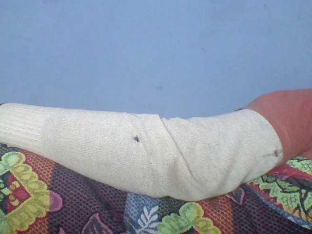 Rema-2
