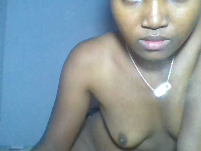 Rema-2