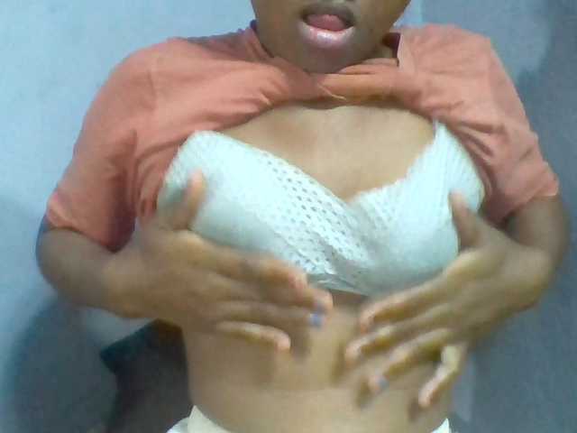 Rema-2
