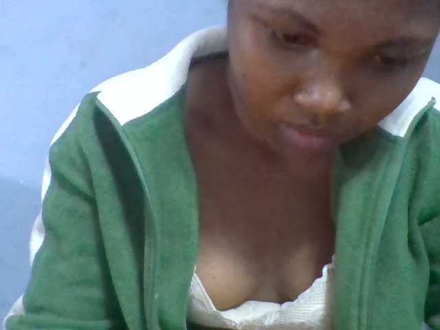 Rema-2