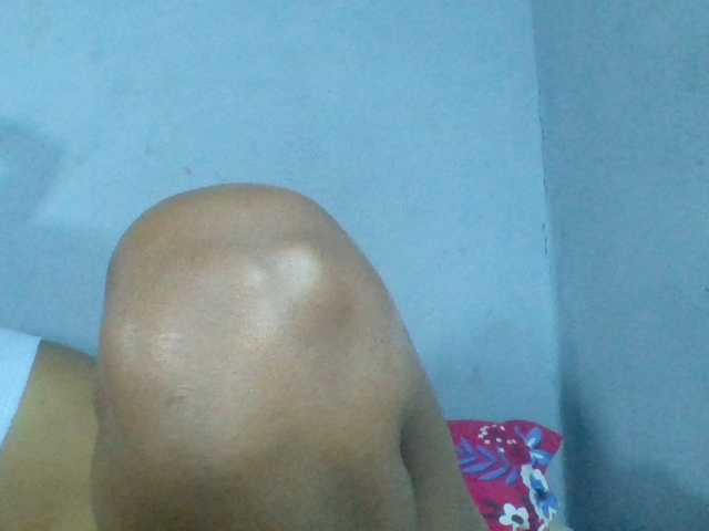 Rema-2