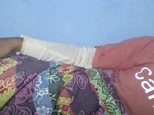 Rema-2