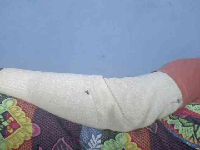 Rema-2